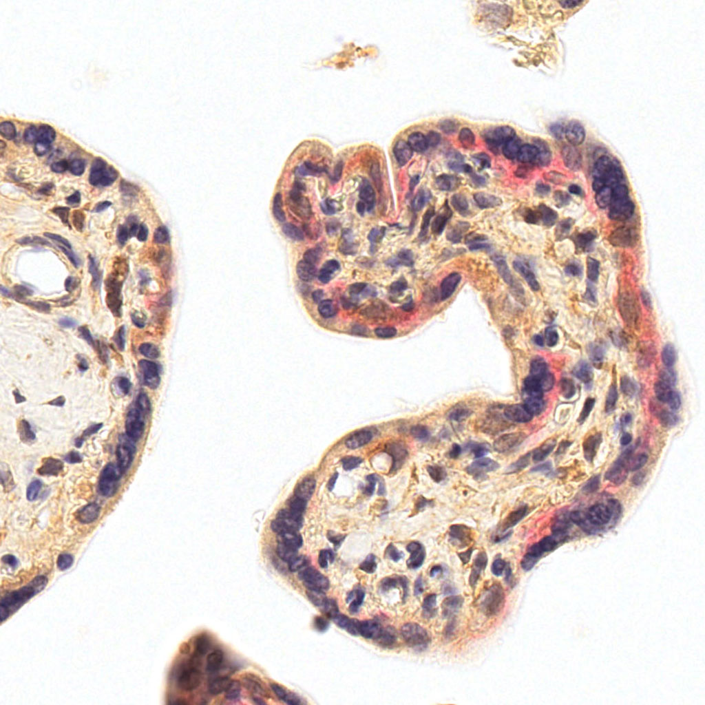 sars-cov-2 gene expression in a human fetus